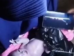Bayi Baru di lahirkan Di temukan di Tempat Sampah PERUMAHAN TYTYAN KENCANA BEKASI UTARA
